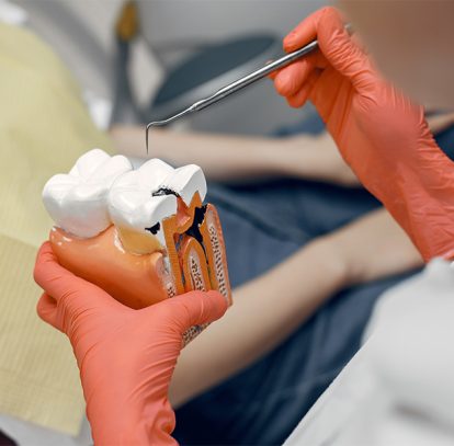 Do You Really Need a Root Canal? 6 Symptoms You Shouldn’t Ignore